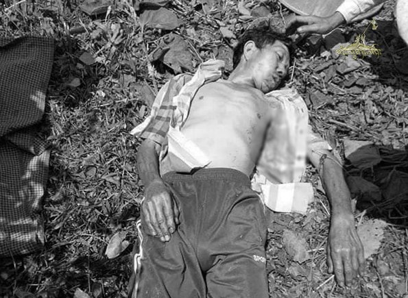 Landmines victims in Shan State